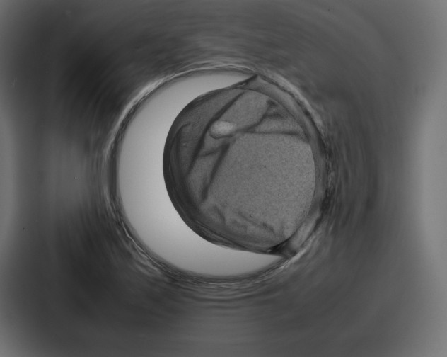 X0000087051171200705160945