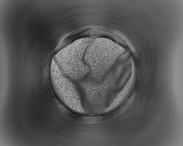 X0000087051185200705160944