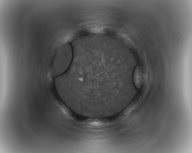 X0000087060658200704181259