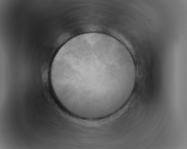 X0000087060010200705161021