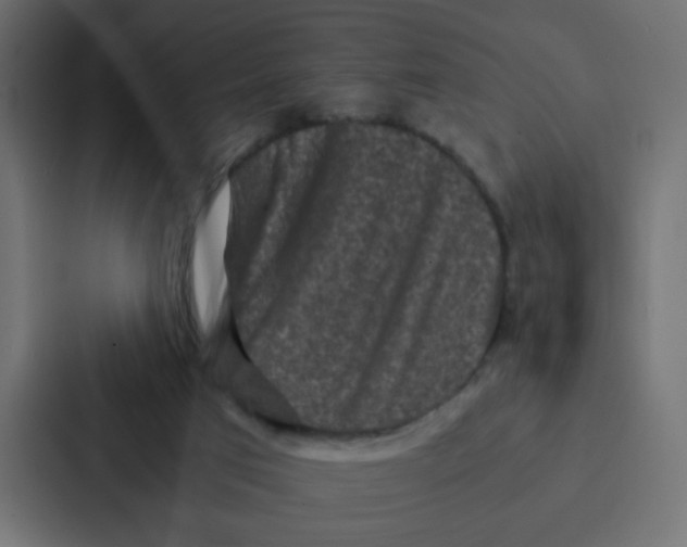 X0000087060017200705161021