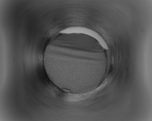 X0000087060045200705161021