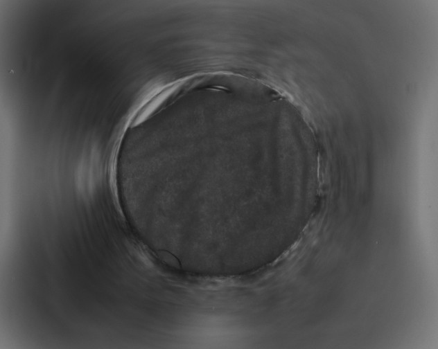 X0000087060099200705161020