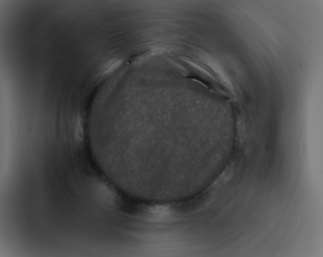 X0000087060114200705161020