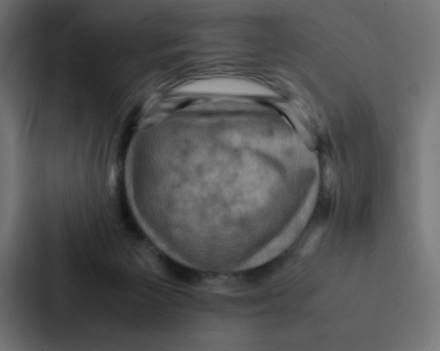 X0000087060125200705161020