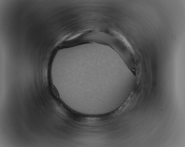 X0000087060154200705161019