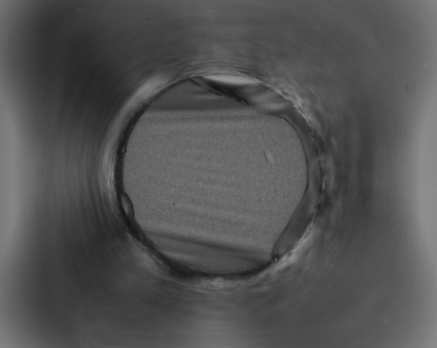 X0000087060197200705161019