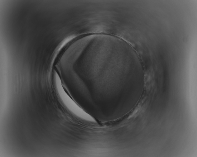 X0000087060200200705161019