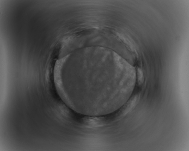 X0000087060229200705161018