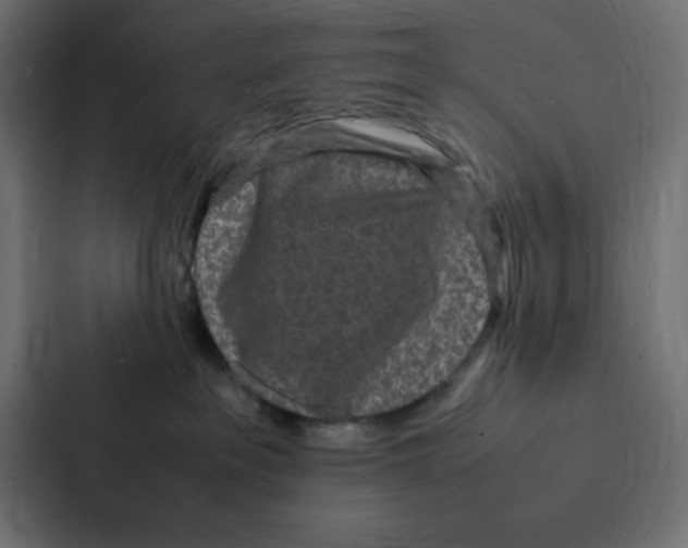 X0000087060237200705161018