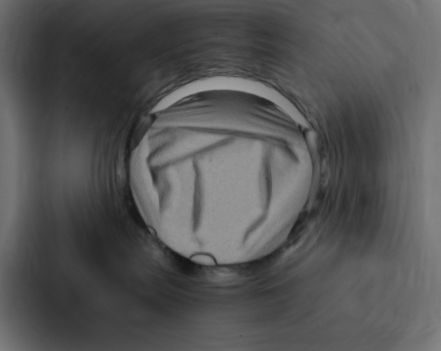 X0000087060287200705161018