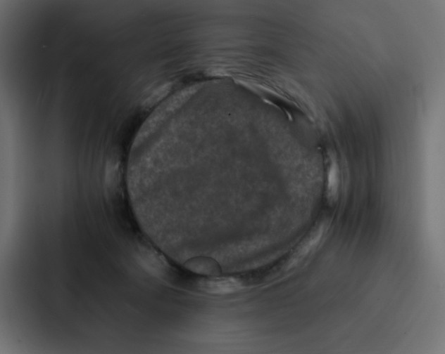 X0000087060322200705161017