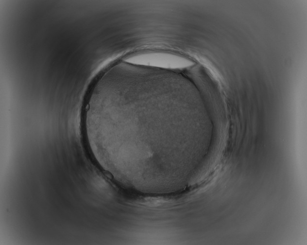 X0000087060391200705161016