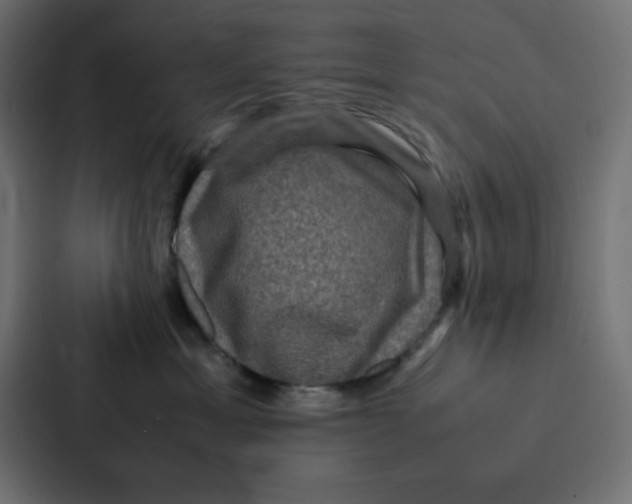 X0000087060429200705161016