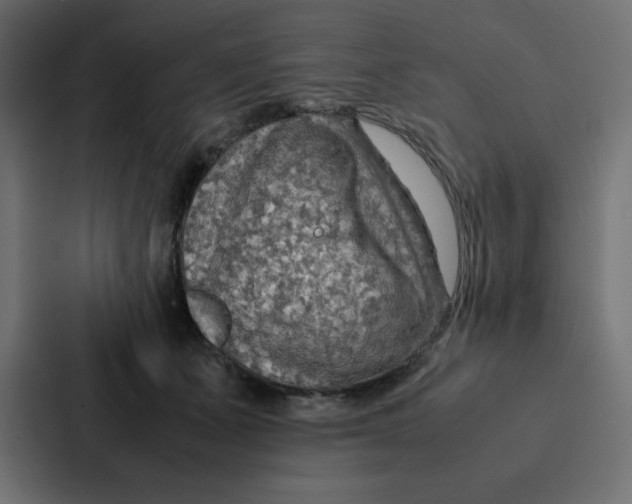 X0000087060511200705161015