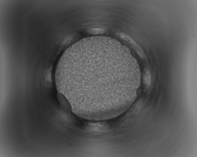 X0000087060516200705161015