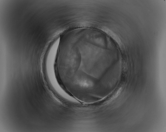 X0000087060581200705161014