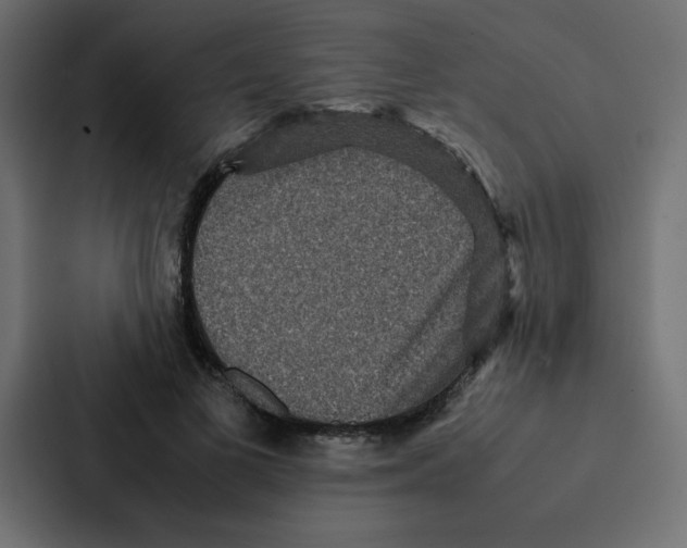 X0000087060693200705161012