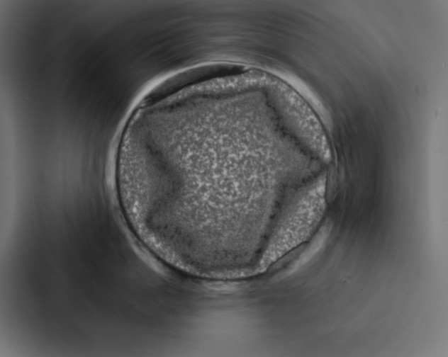 X0000087060862200705161011