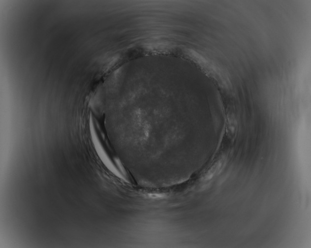 X0000087061010200705161007