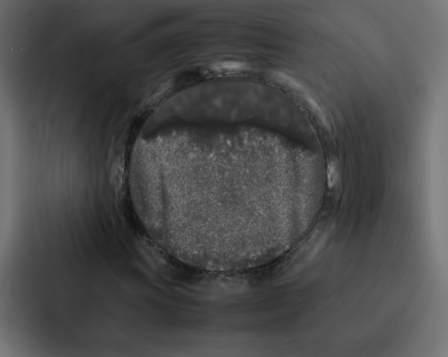 X0000087061011200705161007