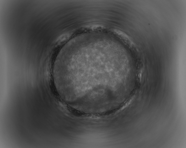 X0000087061014200705161007