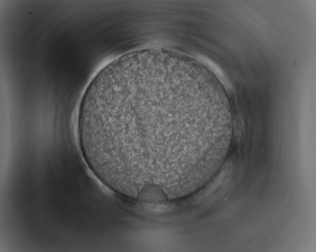 X0000087061103200705161007