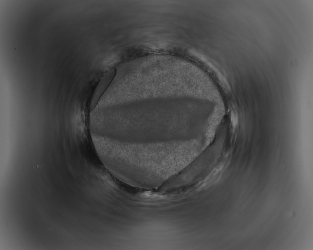 X0000087061156200705161006