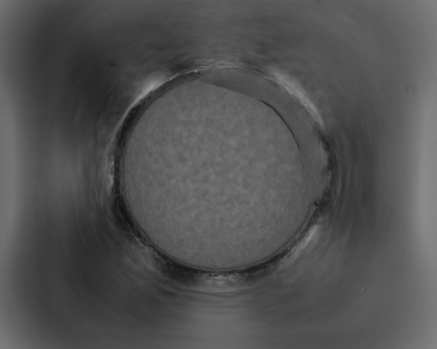 X0000087061165200705161006