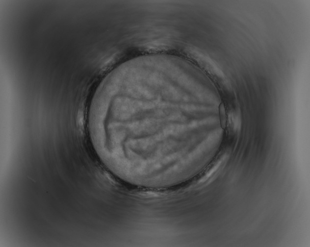 X0000087061300200705161003