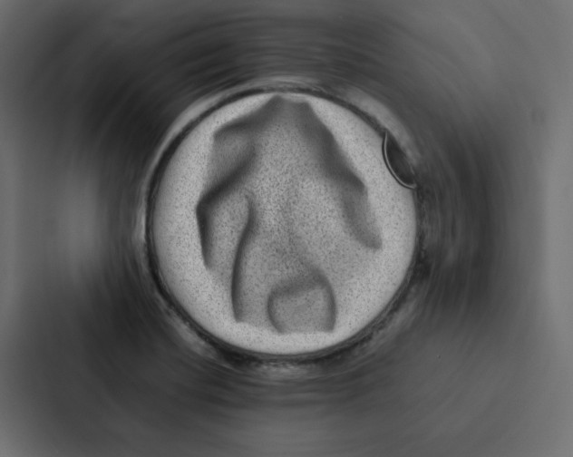 X0000087061420200705161002