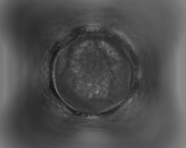 X0000087061445200705161002