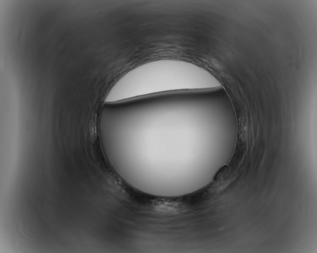 X0000087310471200704200722