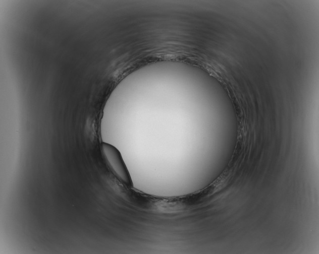 X0000087310568200704200720