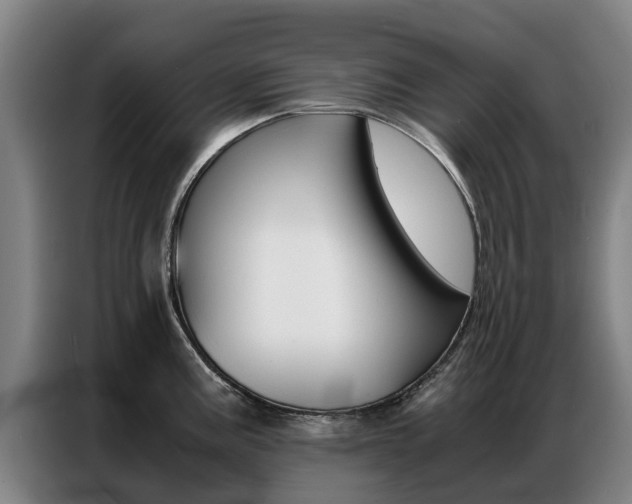 X0000087311195200704200711