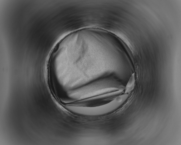 X0000087311151200705112112