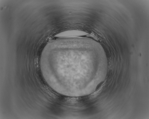 X0000087310182200705180955