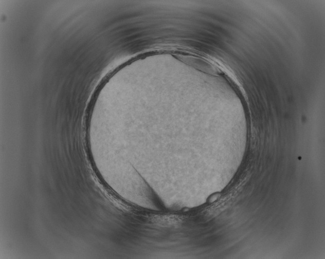 X0000087311045200705180941