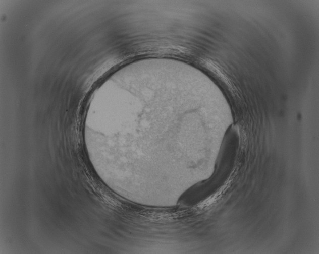 X0000087311071200705180940