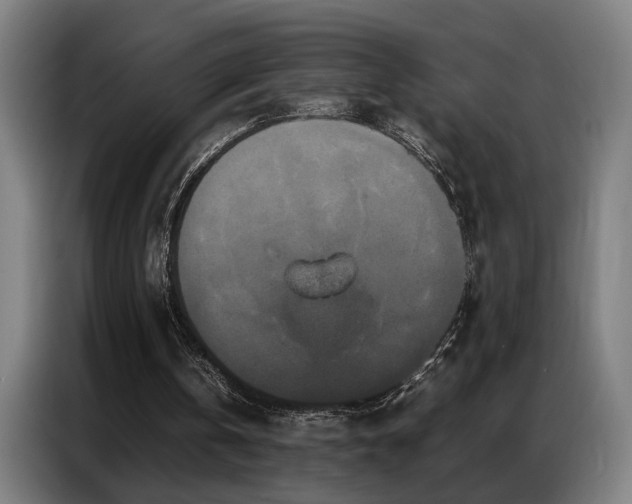 X0000087320146200704201116