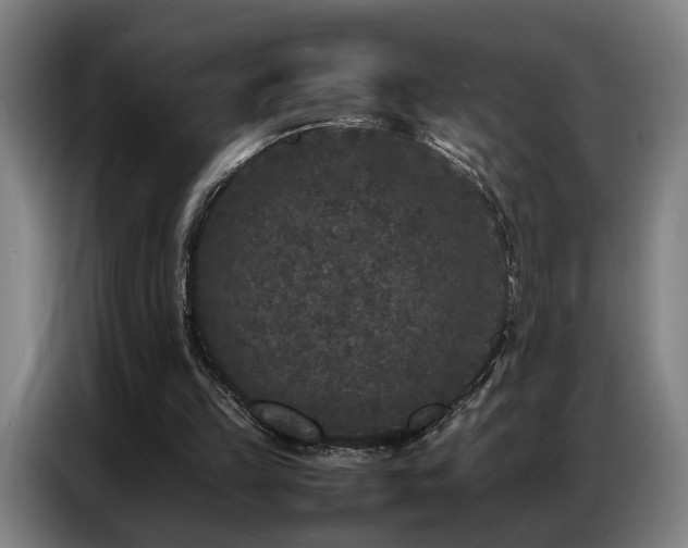X0000087320149200704201116