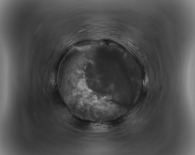 X0000087320331200704201115