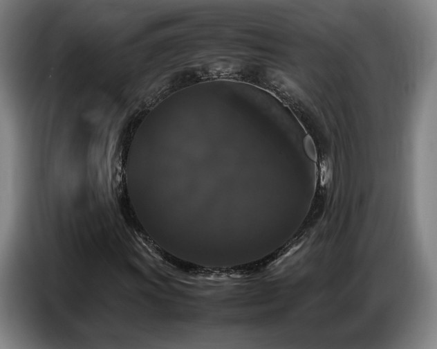 X0000087321011200704201106