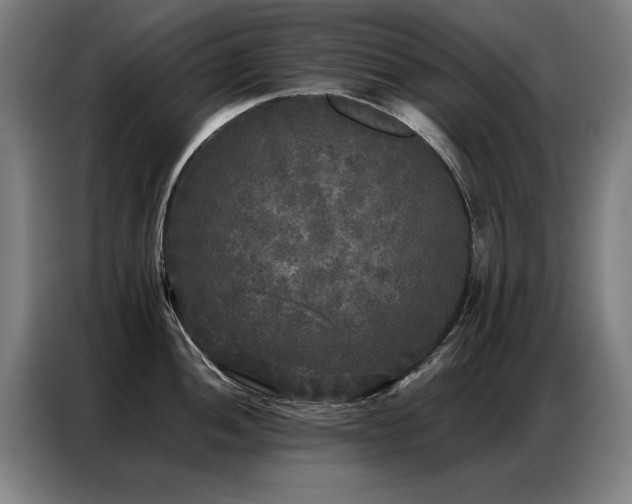 X0000087321052200704201107