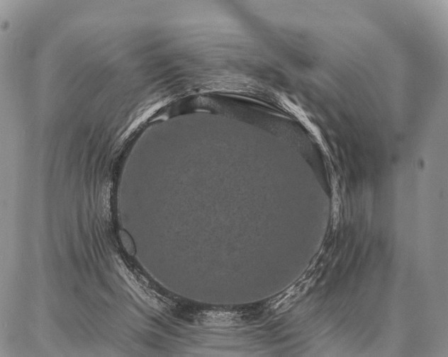 X0000087320154200704271436