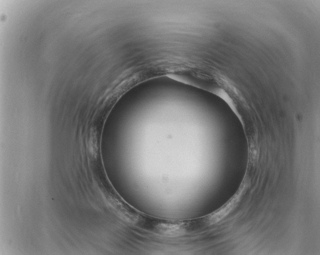 X0000087320170200705041723