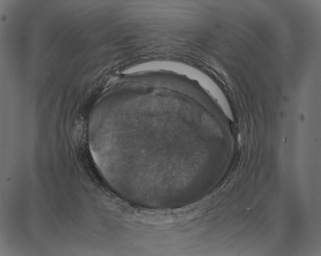 X0000087320029200705181022