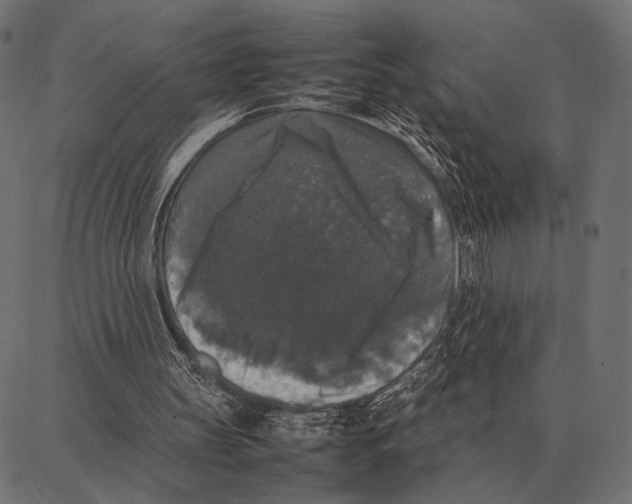 X0000087320147200705181019