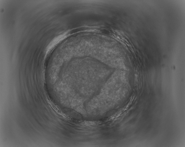 X0000087320149200705181020