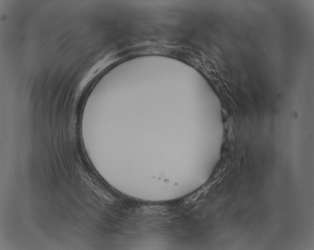 X0000087320150200705181020